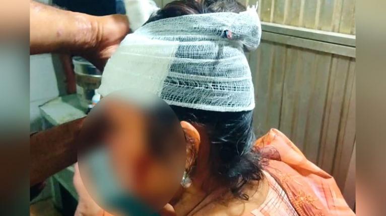 নারায়ণগঞ্জ ছিনতাইকারীর ছুরিকাঘাতে বাউল শিল্পী আহত