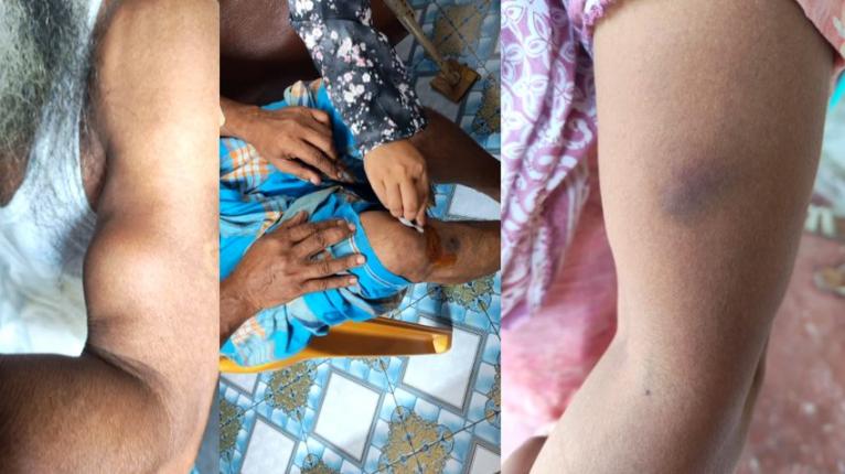সরিষাবাড়ীতে জমি সংক্রান্ত বিরোধে দুই ইউপি সদস্যসহ ৪জন আহত, অতঃপর মামলা